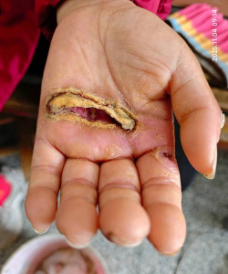 家庭养花用生根粉