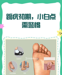 脚长白点怎么办