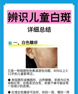 长白斑点是怎么回事