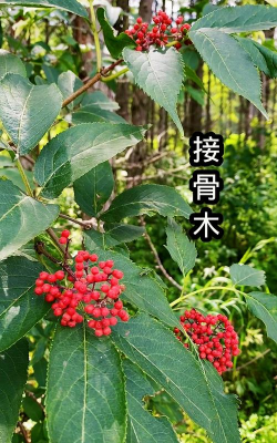 接骨木接骨木是管什么的