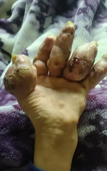 家庭养花用生根粉