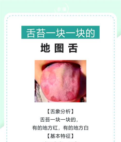 树舌怎么防治,识别早期症状,采取有效方法 树舌怎么防治,识别早期症状,采取有效方法