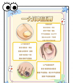 怎么养花甲，掌握关键技巧，轻松养活不翻车