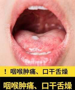 鱼腥草跟折耳根一样吗