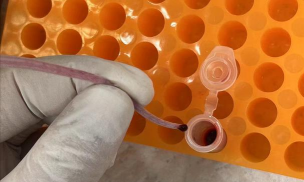 小众送妈妈的花有哪些花