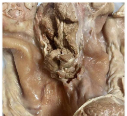 家里阳光不足怎么养花，选对植物种类，掌握养护技巧