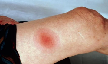 养花陶粒，提升植物生长，优化土壤环境