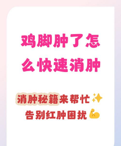 鸡的脚肿了怎么治疗 鸡的脚肿了怎么治疗