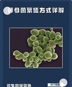 酵母菌的生殖方式 酵母菌的生殖方式